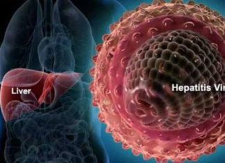Usai 3 Anak Meninggal, Ratusan Kasus Hepatitis Akut Muncul